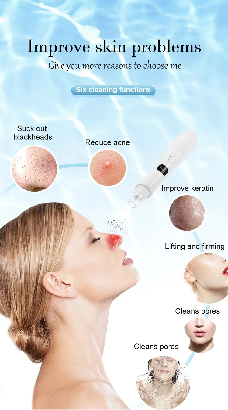 Electric Blackhead Remover Face Cleansing Vacuum