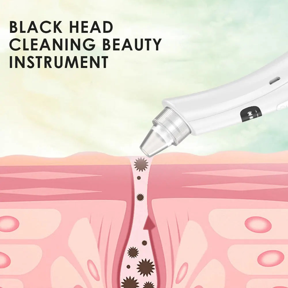 Electric Blackhead Remover Face Cleansing Vacuum