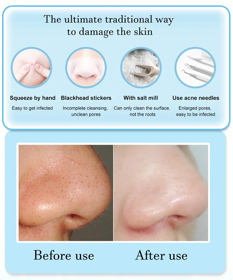 Electric Blackhead Remover Face Cleansing Vacuum